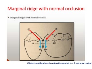 Marginal ridge with normal occlusion
Clinical considerations in restorative dentistry — A narrative review
 
