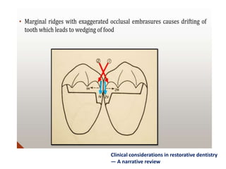 Clinical considerations in restorative dentistry
— A narrative review
 