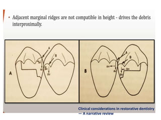 Clinical considerations in restorative dentistry
— A narrative review
 