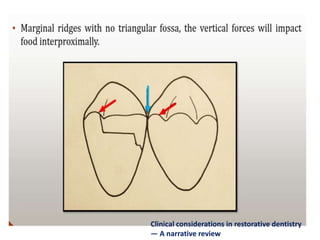 Clinical considerations in restorative dentistry
— A narrative review
 