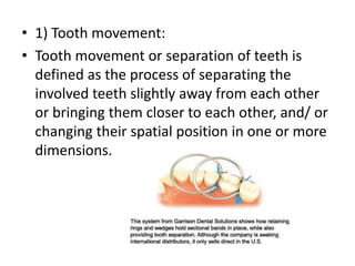• 1) Tooth movement:
• Tooth movement or separation of teeth is
defined as the process of separating the
involved teeth slightly away from each other
or bringing them closer to each other, and/ or
changing their spatial position in one or more
dimensions.
 