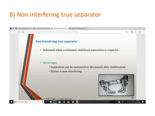 B) Non interfering true separator
 