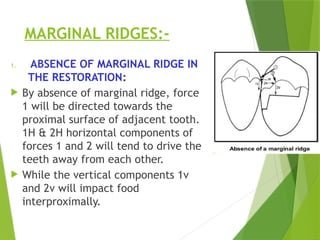 CONTACTS AND CONTOURS In Restorative Dentistry | PPTX