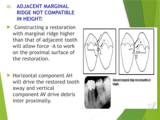 CONTACTS AND CONTOURS In Restorative Dentistry | PPTX