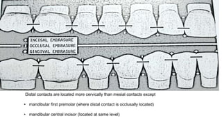 Distal contacts are located more cervically than mesial contacts except
• mandibular first premolar (where distal contact is occlusally located)
• mandibular central incisor (located at same level)
 