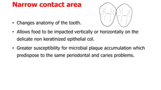 Narrow contact area
• Changes anatomy of the tooth.
• Allows food to be impacted vertically or horizontally on the
delicate non keratinized epithelial col.
• Greater susceptibility for microbial plaque accumulation which
predispose to the same periodontal and caries problems.
 