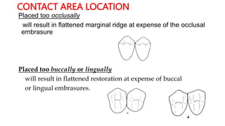 CONTACT AREA LOCATION
Placed too occlusally
will result in flattened marginal ridge at expense of the occlusal
embrasure
Placed too buccally or lingually
will result in flattened restoration at expense of buccal
or lingual embrasures.
 