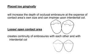 Placed too gingivally
will increase the depth of occlusal embrasure at the expense of
contact area’s own size and can impinge upon interdental col.
Loose/ open contact area
creates continuity of embrasures with each other and with
interdental col
 