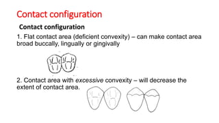 Contact configuration
Contact configuration
1. Flat contact area (deficient convexity) – can make contact area
broad buccally, lingually or gingivally
2. Contact area with excessive convexity – will decrease the
extent of contact area.
 