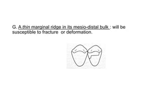 G. A thin marginal ridge in its mesio-distal bulk : will be
susceptible to fracture or deformation.
 