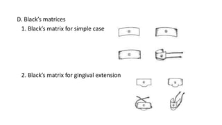 D. Black’s matrices
1. Black’s matrix for simple case
2. Black’s matrix for gingival extension
 