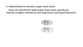 E. Soldered band or Seamless copper band matrix
These are indicated for badly broken down teeth specially pin
retained amalgam restorations with large buccal and lingual extensions.
 