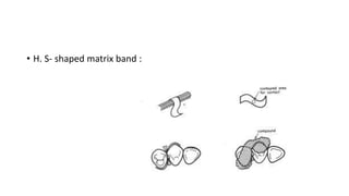 • H. S- shaped matrix band :
 