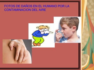 FOTOS DE DAÑOS EN EL HUMANO POR LA
CONTAMINACION DEL AIRE
 