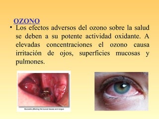 OZONO
• Los efectos adversos del ozono sobre la salud
se deben a su potente actividad oxidante. A
elevadas concentraciones el ozono causa
irritación de ojos, superficies mucosas y
pulmones.
 