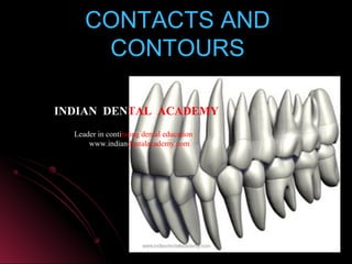 CONTACTS ANDCONTACTS AND
CONTOURSCONTOURS
www.indiandentalacademy.comwww.indiandentalacademy.com
INDIAN DENTAL ACADEMY
Leader in continuing dental education
www.indiandentalacademy.com
 