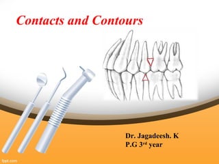 Contacts and Contours
Dr. Jagadeesh. K
P.G 3rd
year
 