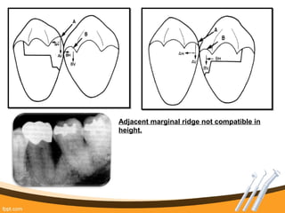 Contacts and Contours by Dr. Jagadeesh Kodithyala | PPT