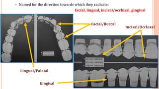 18
• Named for the direction towards which they radicate:
facial, lingual, incisal/occlusal, gingival
Facial/Buccal
Incisal/Occlusal
Lingual/Palatal
Gingival
13
 