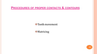 PROCEDURES OF PROPER CONTACTS & CONTOURS
23
Tooth movement
Matricing
 