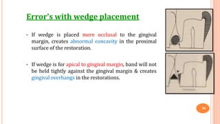 Error’s with wedge placement
• If wedge is placed more occlusal to the gingival
margin, creates abnormal concavity in the proximal
surface of the restoration.
• If wedge is for apical to gingival margin, band will not
be held tightly against the gingival margin & creates
gingival overhangs in the restorations.
34
 