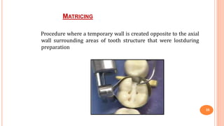MATRICING
35
Procedure where a temporary wall is created opposite to the axial
wall surrounding areas of tooth structure that were lostduring
preparation
 