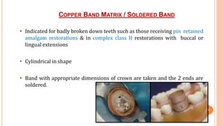 COPPER BAND MATRIX / SOLDERED BAND
44
• Indicated for badly broken down teeth such as those receiving pin retained
amalgam restorations & in complex class II restorations with buccal or
lingual extensions
• Cylindrical in shape
• Band with appropriate dimensions of crown are taken and the 2 ends are
soldered.
 