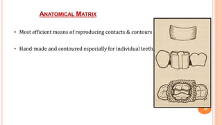 ANATOMICAL MATRIX
45
• Most efficient means of reproducing contacts & contours
• Hand-made and contoured especially for individual teeth.
 