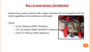 ROLL IN BAND MATRIX ( AUTOMATRIX)
46
• Retainerless matrix system with 4 types of bands that are designed to fit all
teeth regardless of circumference and height.
• Types:
• 3/16” (4.8mm), 0.002” thickness
• 1/4” (6.35mm), 0.002” & 0.0015” thickness
• 5/16” (7.79mm), 0.002” thickness
 