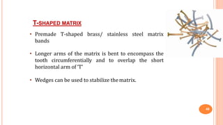 T-SHAPED MATRIX
T-shaped brass/ stainless steel matrix• Premade
bands
• Longer arms of the matrix is bent to encompass the
tooth circumferentially and to overlap the short
horizontal arm of ‘T’
• Wedges can be used to stabilize the matrix.
48
 