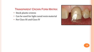 TRANSPARENT CROWN FORM MATRIX
50
• Stock plastic crowns
• Can be used for light cured resin material
• For Class III and Class IV
 