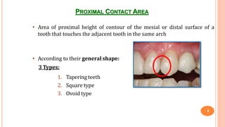 PROXIMAL CONTACT AREA
• Area of proximal height of contour of the mesial or distal surface of a
tooth that touches the adjacent tooth in the same arch
• According to their general shape:
3 Types:
1. Tapering teeth
2. Square type
3. Ovoid type
8
 
