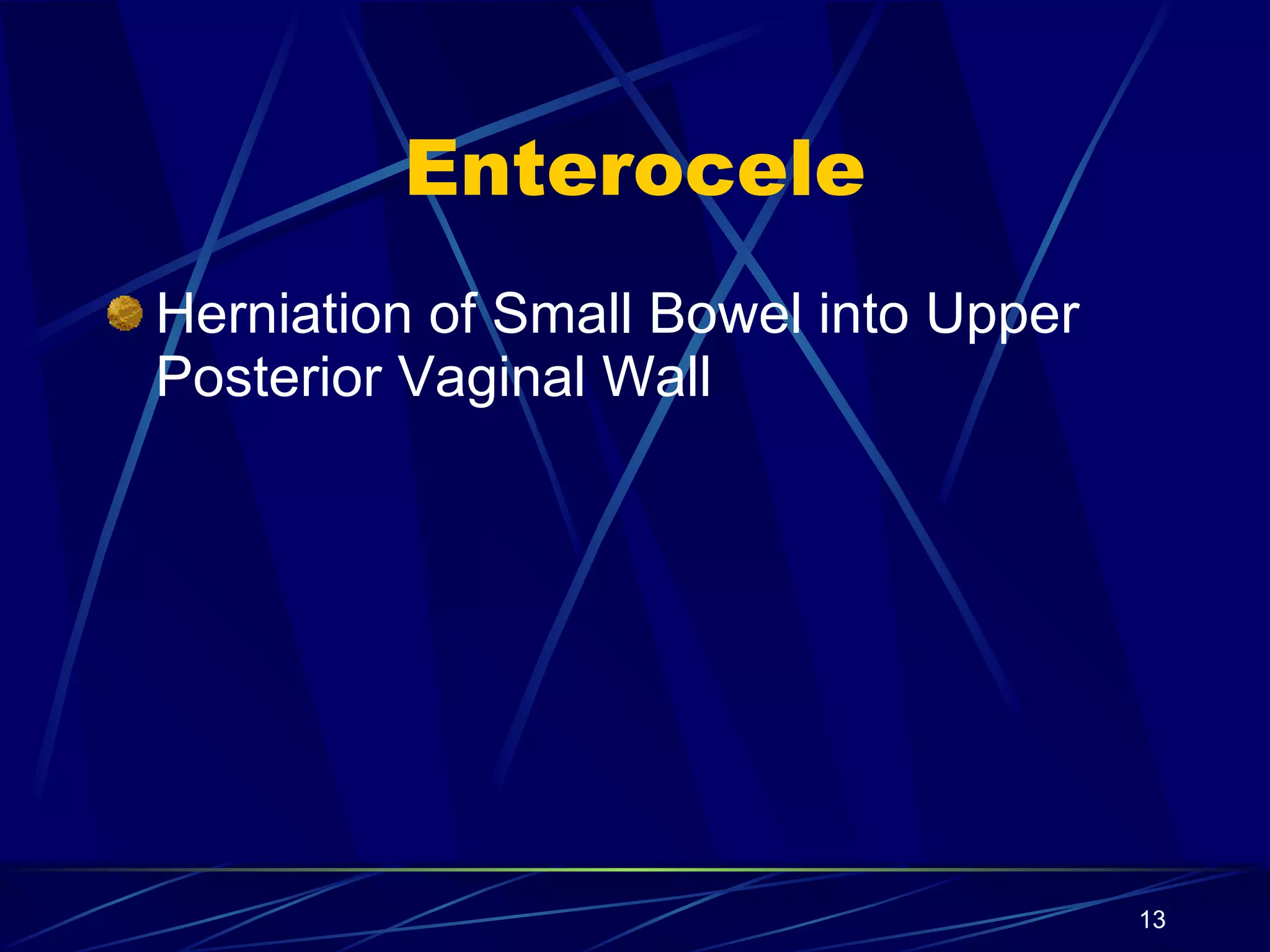 Enterocele Herniation of Small Bowel into Upper Posterior Vaginal Wall 