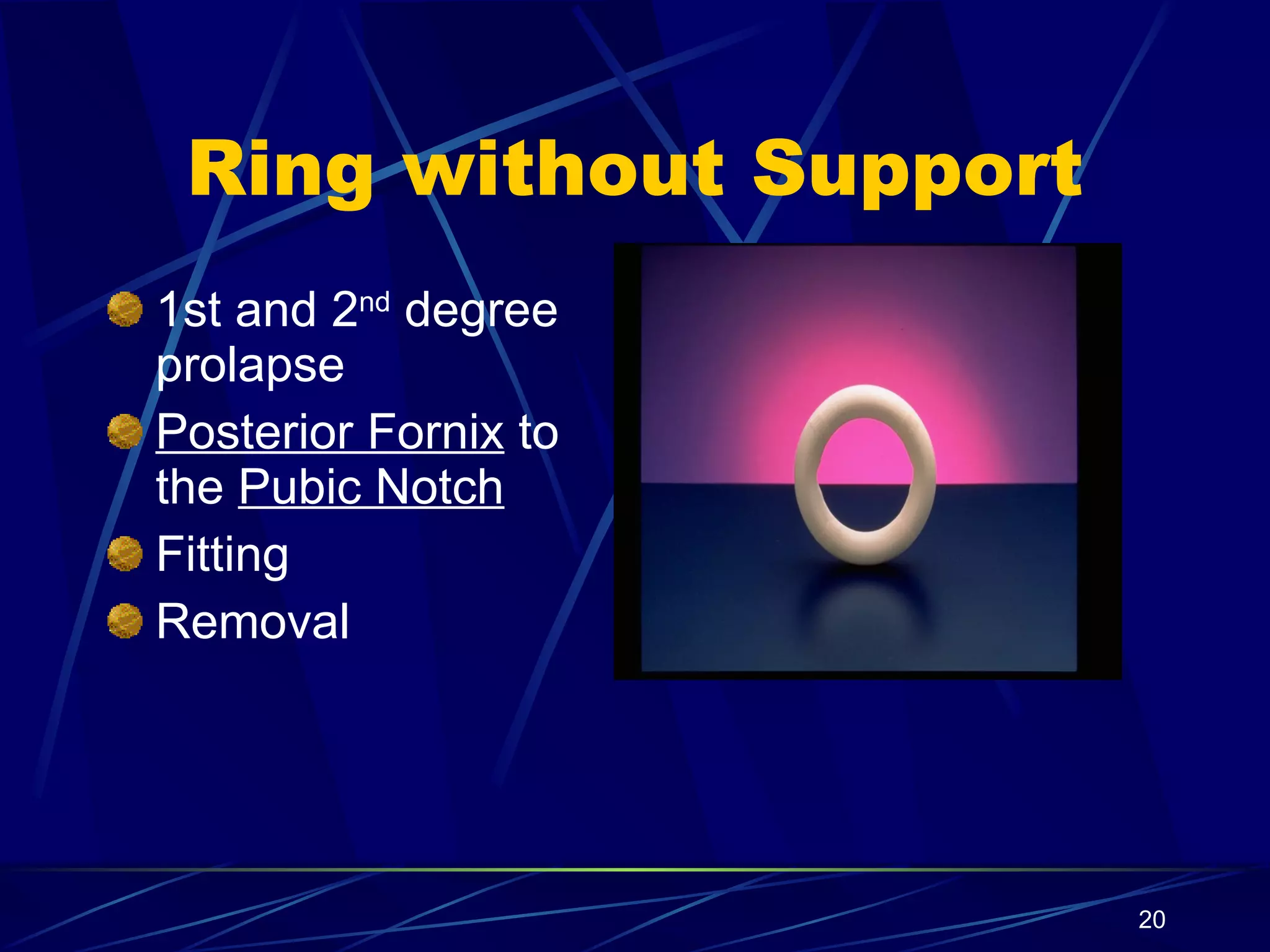Ring without Support 1st and 2 nd  degree prolapse Posterior Fornix  to the  Pubic Notch Fitting Removal 