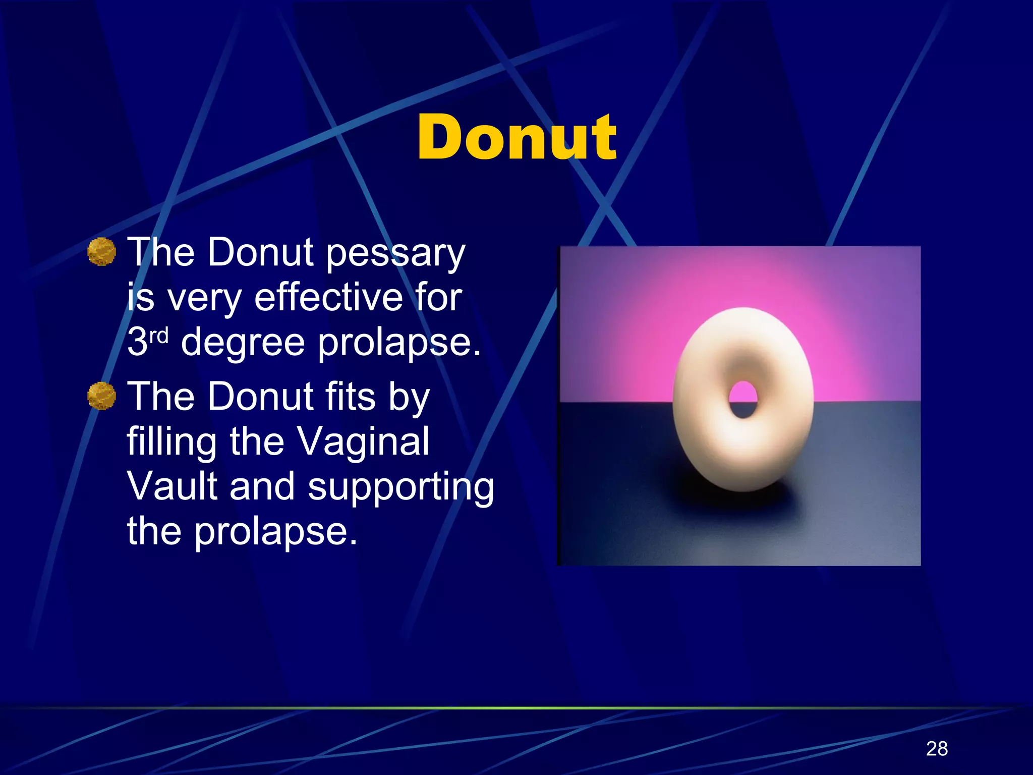 Donut The Donut pessary is very effective for 3 rd  degree prolapse. The Donut fits by filling the Vaginal Vault and supporting the prolapse. 