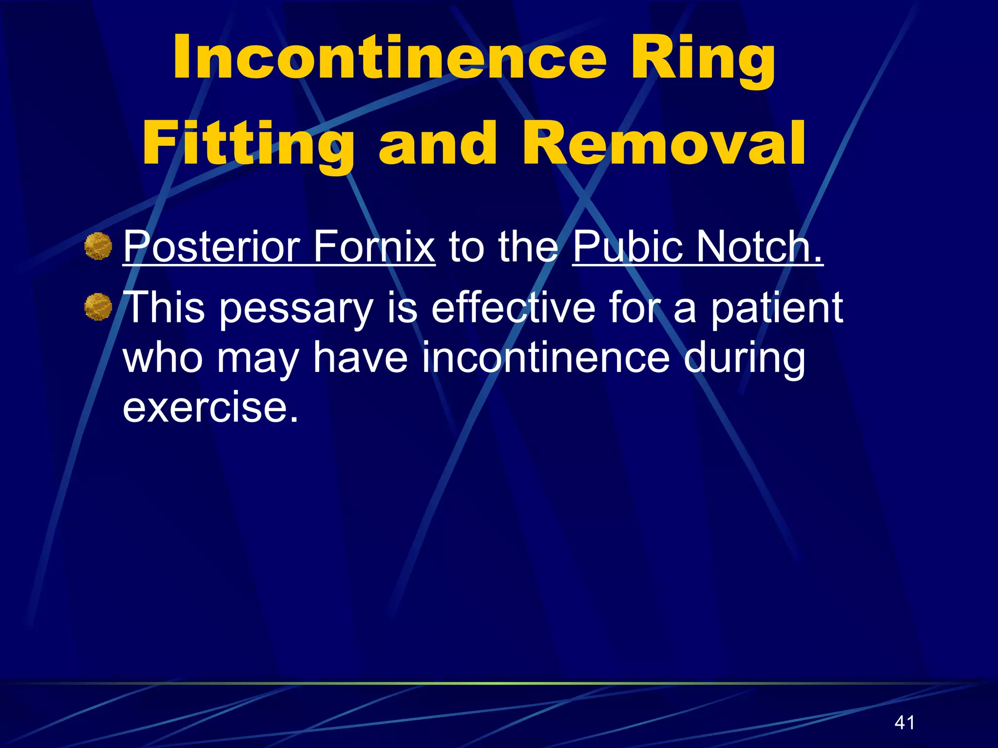 Incontinence Ring Fitting and Removal Posterior Fornix  to the  Pubic Notch. This pessary is effective for a patient who may have incontinence during exercise. 
