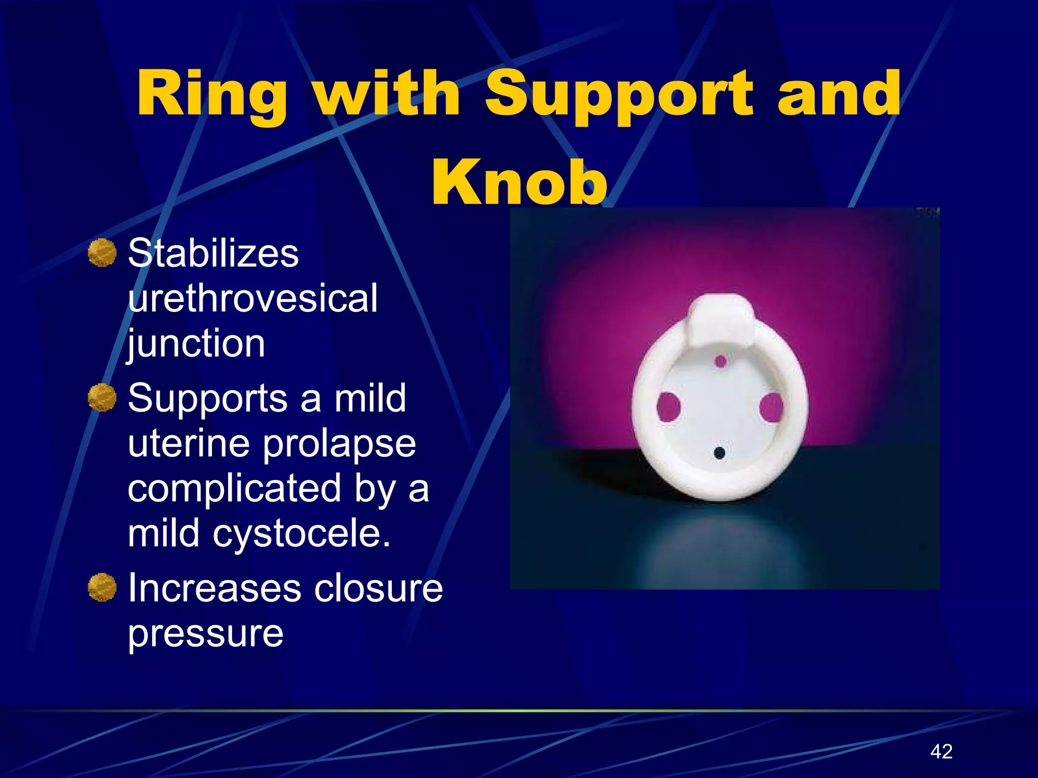 Ring with Support and Knob Stabilizes urethrovesical junction Supports a mild uterine prolapse complicated by a mild cystocele. Increases closure pressure 