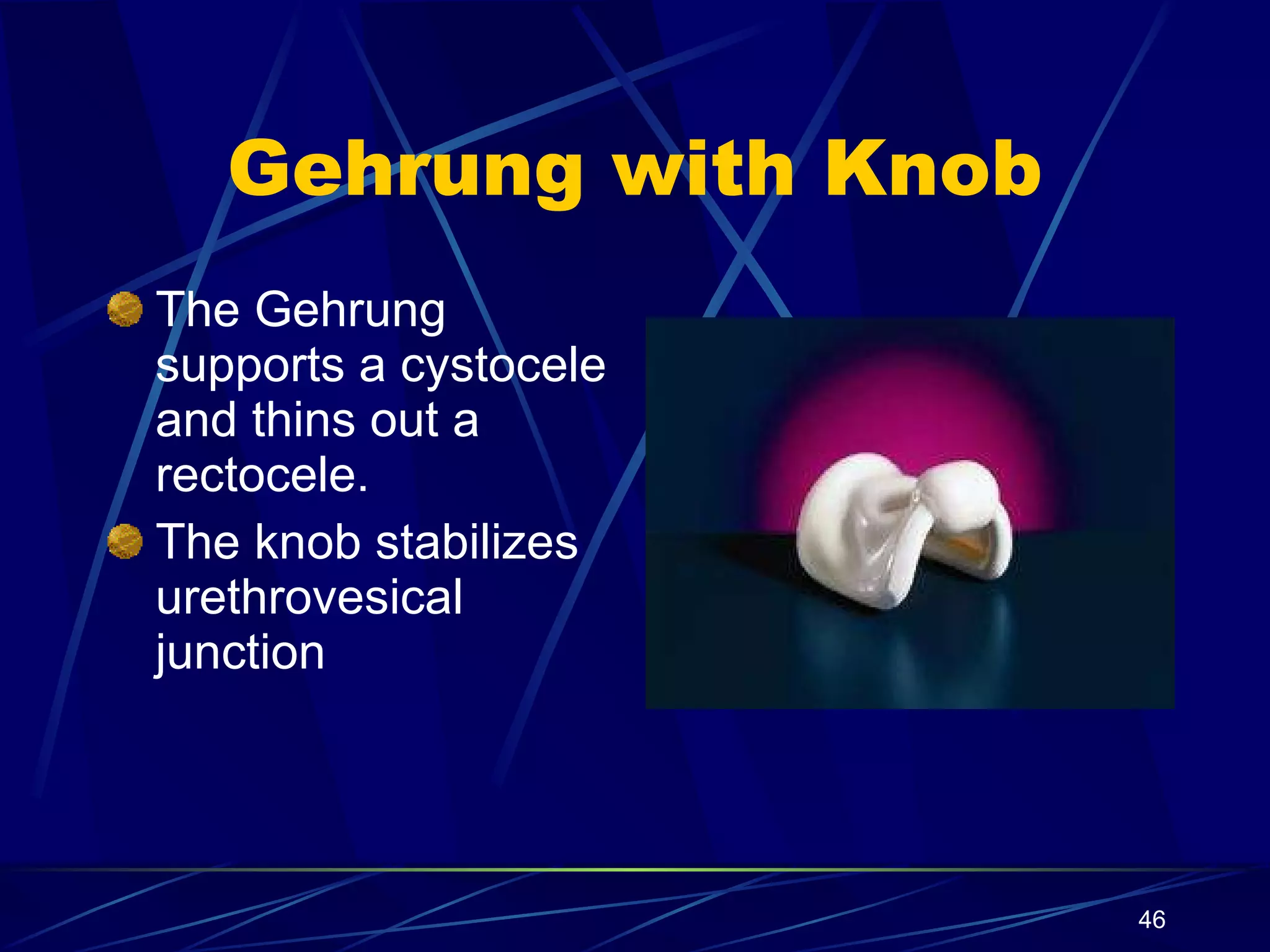 Gehrung with Knob The Gehrung supports a cystocele and thins out a rectocele.  The knob stabilizes urethrovesical junction 