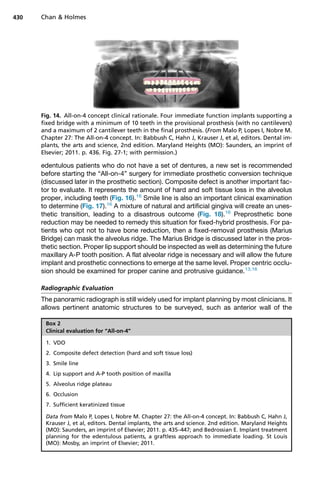 edentulous patients who do not have a set of dentures, a new set is recommended
before starting the “All-on-4” surgery for immediate prosthetic conversion technique
(discussed later in the prosthetic section). Composite defect is another important fac-
tor to evaluate. It represents the amount of hard and soft tissue loss in the alveolus
proper, including teeth (Fig. 16).16
Smile line is also an important clinical examination
to determine (Fig. 17).16
A mixture of natural and artificial gingiva will create an unes-
thetic transition, leading to a disastrous outcome (Fig. 18).16
Preprosthetic bone
reduction may be needed to remedy this situation for fixed-hybrid prosthesis. For pa-
tients who opt not to have bone reduction, then a fixed-removal prosthesis (Marius
Bridge) can mask the alveolus ridge. The Marius Bridge is discussed later in the pros-
thetic section. Proper lip support should be inspected as well as determining the future
maxillary A-P tooth position. A flat alveolar ridge is necessary and will allow the future
implant and prosthetic connections to emerge at the same level. Proper centric occlu-
sion should be examined for proper canine and protrusive guidance.13,16
Radiographic Evaluation
The panoramic radiograph is still widely used for implant planning by most clinicians. It
allows pertinent anatomic structures to be surveyed, such as anterior wall of the
Fig. 14. All-on-4 concept clinical rationale. Four immediate function implants supporting a
fixed bridge with a minimum of 10 teeth in the provisional prosthesis (with no cantilevers)
and a maximum of 2 cantilever teeth in the final prosthesis. (From Malo P, Lopes I, Nobre M.
Chapter 27: The All-on-4 concept. In: Babbush C, Hahn J, Krauser J, et al, editors. Dental im-
plants, the arts and science, 2nd edition. Maryland Heights (MO): Saunders, an imprint of
Elsevier; 2011. p. 436. Fig. 27-1; with permission.)
Box 2
Clinical evaluation for “All-on-4”
1. VDO
2. Composite defect detection (hard and soft tissue loss)
3. Smile line
4. Lip support and A-P tooth position of maxilla
5. Alveolus ridge plateau
6. Occlusion
7. Sufficient keratinized tissue
Data from Malo P, Lopes I, Nobre M. Chapter 27: the All-on-4 concept. In: Babbush C, Hahn J,
Krauser J, et al, editors. Dental implants, the arts and science. 2nd edition. Maryland Heights
(MO): Saunders, an imprint of Elsevier; 2011. p. 435–447; and Bedrossian E. Implant treatment
planning for the edentulous patients, a graftless approach to immediate loading. St Louis
(MO): Mosby, an imprint of Elsevier; 2011.
Chan  Holmes
430
 
