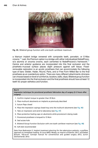 a titanium implant bridge veneered with composite teeth, porcelain, or E-Max
crowns.27
Last, the Premium option is a bridge with either individualized NobelProce-
ra’s alumina or zirconia crowns, each cemented to NobelProcera’s framework.27
Canine and anterior guidance are incorporated into this final occlusion and the
prosthetic-mucosal surface places slight pressure against soft tissue. Fixed-
removable restoration is an acrylic prosthesis that can accommodate the following
type of bars: Dolder, Hader, Round, Paris, and or Free Form Milled Bar to the final
prosthesis as an overdenture option. There are many different attachments clinicians
can choose based on level of comfort (ie, locators, balls, clips). Bilateral group function
is incorporated into the final occlusion and the final prosthesis should have at least 12
teeth for proper esthetics and function.
Fig. 45. Bilateral group function with one-tooth cantilever maximum.
Box 8
Impression technique for provisional prosthesis fabrication day of surgery (2–3 hours after
surgery)
1. Confirm implant torque to greater than 35 Ncm
2. Place multiunit abutments on implants as previously described
3. Suture flaps closed
4. Place the impression copings closed tray onto the multiunit abutments (see Fig. 46)
5. Take an impression and send to laboratory (see Fig. 47)
6. Place protective healing caps on abutments while provisional is being made
7. Provisional prosthesis is torqued to 15 Ncm
8. Seal access hole
9. Bilateral Group Function Occlusion with one tooth cantilever maximum (see Fig. 48)
10. Soft diet recommended
Data from Bedrossian E. Implant treatment planning for the edentulous patients, a graftless
approach to immediate loading. St Louis (MO): Mosby, an imprint of Elsevier; 2011; and Nobel
Biocare “All-on-4” Concept manual for conventional and guided surgery 2012, Zurich
(Switzerland): 2012.
Chan  Holmes
446
 