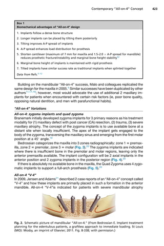 Building on the mandibular “All-on-4” success, Malo and colleagues replicated the
same design for the maxilla in 2005.4
Similar successes have been duplicated by other
authors11,17,18
; however, most would advocate the use of additional 2 maxillary im-
plants for patients when encountered with certain risk factors (ie, poor bone quality,
opposing natural dentition, and men with parafunctional habits).
“All-on-4” Variations
All-on-4: zygoma implants and quad zygoma
Branemark initially developed zygoma implants for 3 primary reasons as his treatment
modality for (1) maxillary defect with post cancer (CA) resection, (2) trauma, (3) severe
maxillary atrophy. The concept of the zygoma implants is to use available bone at a
distant site when locally insufficient. The apex of the implant gets engaged to the
body of the zygoma, transversing the maxillary sinus and emerging from the first molar
position at a 45
angle.19
Bedrossian categorizes the maxilla into 3 zones radiographically: zone 1 5 premax-
illa, zone 2 5 premolar, zone 3 5 molar (Fig. 3).20
The zygoma implants are indicated
where there is insufficient bone in the premolar and molar regions, leaving only the
anterior premaxilla available. The implant configuration will be 2 axial implants in the
anterior position and 2 zygoma implants in the posterior region (Fig. 4).20
If there is absolutely no available bone in the maxilla, the Quad Zygoma uses 4 zygo-
matic implants to support a full-arch prosthesis (Fig. 5).20
All-on-4 “V-4”
In 2009, Jensen and Adams21
described 2 case reports of an “All-on-4” concept called
“V-4” and how these implants are primarily placed in such a formation in the anterior
mandible. All-on-4 “V-4”is indicated for patients with severe mandibular atrophy
Box 1
Biomechanical advantages of “All-on-4” design
1. Implants follow a dense bone structure
2. Longer implants can be placed by tilting them posteriorly
3. Tilting improves A-P spread of implants
4. A-P spread enhances load distribution for prosthesis
5. Shorten cantilever (maximum of 7 mm for maxilla and 1.5–2.0  A-P spread for mandible)
reduces prosthetic fracture/instability and marginal bone height stability52
6. Marginal bone height of implants is maintained with rigid prosthesis
7. Tilted implants have similar success rate as traditional implants when splinted together
Data from Refs.3–12
Fig. 2. Schematic picture of mandibular “All-on-4.” (From Bedrossian E. Implant treatment
planning for the edentulous patients, a graftless approach to immediate loading. St Louis
(MO): Mosby, an imprint of Elsevier; 2011. Fig. 8-33B; with permission.)
Contemporary “All-on-4” Concept 423
 