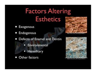 Factors Altering
Esthetics
• Exogenous
• Endogenous
• Defects of Enamel and Dentin
•
•

http://www.sciencephoto.com/images/showEnlarged.html/
P486115-Tooth_enamel,_SEM-SPL.jpg?id=804860115

Environmental
Hereditary

• Other factors

http://www.sciencephoto.com/images/showFullWatermarked.html/
P486153-Tooth_dentine,_SEM-SPL.jpg?id=804860153

 