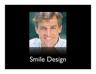 Smile Design

 