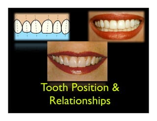Tooth Position &
Relationships

 