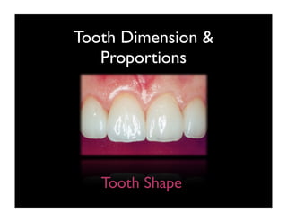 Tooth Dimension &
Proportions

Tooth Shape

 