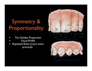 Symmetry &
Proportionality
•
•
•

The Golden Proportion
Visual Width
Repeated Ratio (more more
practical)

http://c1-preview.prosites.com/10426/wy/images/Embrasures.gifweb.gif

http://c1-preview.prosites.com/10426/wy/images/Tooth%20proportionweb.gif

 