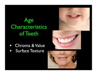 Age
Characteristics
of Teeth
• Chroma & Value
• Surface Texture

 