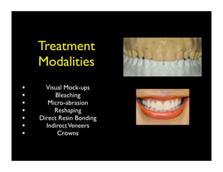 Treatment
Modalities
•
•
•
•
•
•
•

Visual Mock-ups
Bleaching
Micro-abrasion
Reshaping
Direct Resin Bonding
Indirect Veneers
Crowns

 