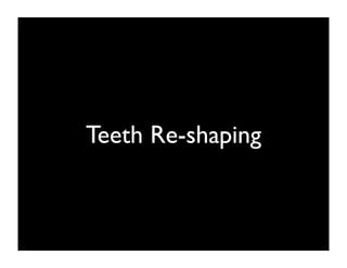 Teeth Re-shaping

 