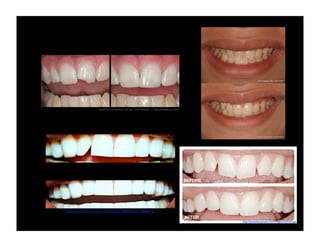 http://www.charlesortiz.net/wp-content/uploads/2009/07/Patients-588x391.jpg
http://bansaldentalcare.com/images/contour.jpg

 